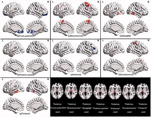 Figure 5. Paired comparison for functional connectivity mapping of the functional thalamic seeds with cortical cortex in both thermal conditions. Functional connectivity of the thalamic “fronto-polar/ACC” and “prefrontal” seeds was markedly attenuated during hyperthermia, whereas functional connectivity of the thalamic “motor/premotor”, “occipital”, “temporal” and “somatosensory” seeds appeared higher during hyperthermia.