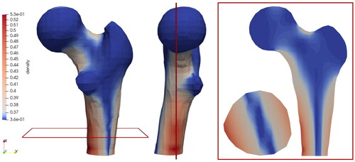 Figure 10. Density distribution inside a femoral head using the classical local approach.
