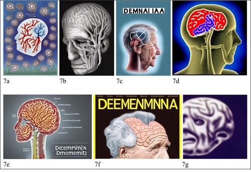 Figure 7. The brain of people with dementia.