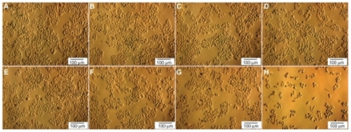 Figure 4 Normal (A–D) and CD44 knockdown (E–H) cells were treated with doxorubicin at four different concentrations: 0 (A, E), 1 (B, F), 3 (C, G), and 6 μg/mL (D, H).