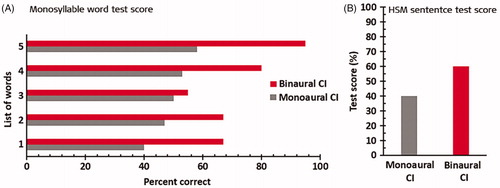Figure 4. (A) Monosyllabic word scores at 80 dB sound pressure level (SPL) of the very first patient. (B) Test scores in noise (numbers, HSM sentences, monosyllabic words, S/N ratio 5-13 dB) for 4 bilaterally implanted adult patietns (n = 17 tests).