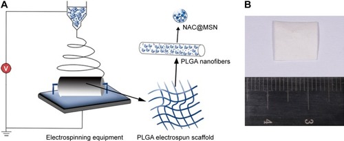 Figure 1 Fabrication of the NAC-loaded PLGA electrospun scaffold and PNNM electrospun scaffold.Notes: Fabrication of the PLGA electrospun scaffold (A) showing fiber formation. Fibers are organized on the rotor receiver of the equipment. Gross view of the PNNM electrospun scaffold (B) NAC@MSN particles and NAC are embedded in the fibers. Reprinted from Acta Biomater, 8(5), Song B, Wu C, Chang J, Dual drug release from electrospun poly(lactic-co-glycolic acid)/mesoporous silica nanoparticles composite mats with distinct release profiles, 1901–1907, Copyright (2012), with permission from Elsevier.Citation22Abbreviations: NAC, N-acetyl cysteine; PLGA, polylactic-co-glycolic acid; MSNs, mesoporous silica nanoparticles; PNNM, PLGA with free NAC and NAC@MSN.