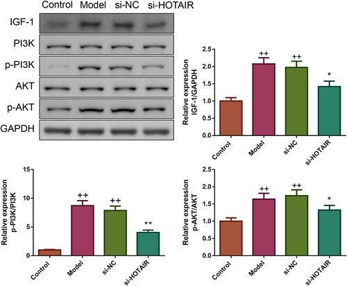 Figure 5. HOTAIR downregulation inhibited IGF-1 expression and PI3K/Akt pathway in PCOS rats. The expression of IGF-1 protein as well as the phosphorylation of PI3K and Akt in rats’ ovarian tissues was tested by western blotting.