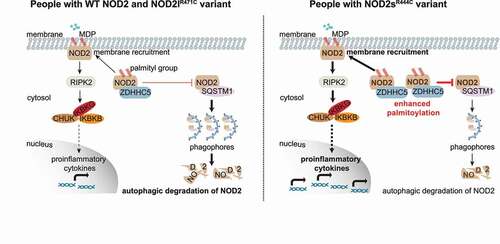 Figure 1. A proposed working model to illustrate how the NOD2sR444C variant contributes to excessive inflammation. Upon muramyl dipeptide (MDP) stimulation, NOD2 undergoes self-oligomerization and recruits RIPK2 to trigger NFKB activation and proinflammatory cytokine production. Normally, palmitoylation of NOD2s by ZDHHC5 promotes the membrane recruitment of NOD2 and restricts the SQSTM1-mediated autophagic degradation of NOD2. In patients with the NOD2sR444C variant, palmitoylation of NOD2s is largely increased through its enhanced protein interaction with ZDHHC5. Increased NOD2 palmitoylation might reduce the threshold of NOD2 activation, leading to excessive NOD2-mediated inflammation and the risk of developing inflammatory diseases.
