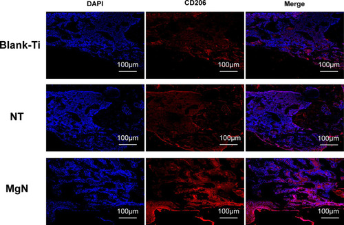 Figure 6 Detection of M2 marker (CD206) in tissue sections from rat bone by immunolabeling and confocal immunofluorescence imaging.Notes: The area of CD206-positive sites (M2; red) was the smallest in blank Ti and NT groups and the largest in the MgN group.Abbreviation: CD206, the surface markers M2 of macrophages.