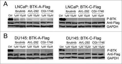 Figure 6. BTK phosphorylation is reduced after treatment with BTK inhibitors in prostate cancer cells. (A) LNCaP or (B) DU145 cells containing the stably integrated BTK-A-Flag, BTK-C-Flag or control vector were treated with Ibrutinib, AVL-292 and CGI-1746 at the indicated concentrations or DMSO as a control for 24h, then cells were lysed, subjected to western blot analysis and probed with the indicated antibodies.