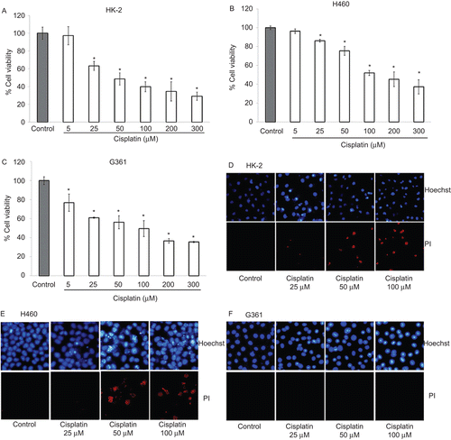 Figure 1.  Cytotoxic effect of cisplatin on HK-2, H460, and G361 cells. (A–C) Cells were treated with various concentrations of cisplatin (0–300 µM) for 24 h and cell viability was measured by MTT assay. Values are means ± SD of three independent experiments, *P < 0.05 versus non-treated control. (D–F) Apoptotic and necrotic cells were detected by Hoechst 33342 and propidium iodide co-staining assay and examined under a fluorescence microscope.