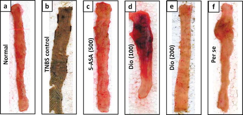 Figure 1. Morphological representation of colons from Normal (a), TNBS control (b), 5-ASA (500 mg/kg) (c), Diosgenin (100 mg/kg) (d), Diosgenin (200 mg/kg) (e) and Per Se (f) treated rats.