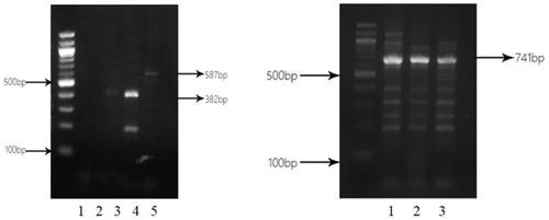 Figure 3 Electrophoresis of PCR products of blaIMP, blaVIM, and blaSIM. Left panel: lane 1. CRPA38 isolate without blagGIM PCR product (562 bp); lane 2: CRPA38 isolate without blaSPM PCR product (784 bp); lanes 3 and 4: CRPA38 and CRPA48 isolates with blaVIM PCR product (382 bp); lane 5: CRPA42 isolate with blaIMP PCR product (587 bp). Right panel: lane 1: CRPA30 isolate with blaSIM PCR product (741 bp); lane 2: CRPA35 isolate with blaSIM PCR product (741 bp); lane 3: CRPA36 isolate with blaSIM PCR product (741 bp).