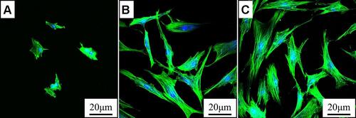 Figure 5 CLSM images of morphologies of MC3T3-E1 cells on PEEK (A), 80FPK (B) and 160FPK (C) at 24 hours after culturing.