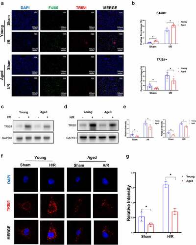 Figure 3. Aging suppressed macrophage TRIB1 in hepatic I/R. Young or aged mice (n = 6 mice per group) were subjected to liver partial warm ischemia for 1.5 hr followed by 6 hr of reperfusion. TRIB1 in F4/80+ macrophages in liver tissue sections detected by IHC (a), and percentages were evaluated by ImageJ software (b). Western blotting analysis of TRIB1 protein extracted from I/R-stressed liver tissues (c) or H/R-stressed BMDMs (d), and relative intensity levels were analyzed by ImageJ software (e). TRIB1 detected by IF in BMDMs (f), and relative intensity levels were analyzed by ImageJ software (g). Data are presented as the mean ± SEM and performed by one-way analysis, P values <0.05 (two-tailed) were considered statistically significant.