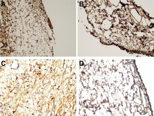 Figure 2 Immunohistochemistry microphotographs showing the intensities of transforming growth factor-β immunostaining of one rabbit from each of the sham and treatment groups.