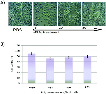 Figure 3. (A) Kinetics of A549 cells treatment with PLA2 (1.5 × 10−6 mol L− 1 and Trypan blue staining at 30 min). (B) In vitro cytotoxic effect of pure sPLA2 (0.5 to 1.5 × 10−6 mol L−1 on A549 cells after two hours of exposure to different snake venom sPLA2 concentrations.
