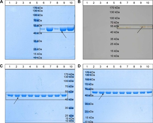 Figure 4 Physical stability of the novel nanoemulsion vaccine.Notes: (A) Primary structural integrity of the antigen protein. (B) Structural specificity of the antigen protein. (C) Primary structural integrity after storage at different temperatures. (D) Stability after long-term storage. Blank nanoemulsion supernatant: lane 1; blank nanoemulsion precipitate: lane 2; blank nanoemulsion treatment supernatant: lane 3; blank nanoemulsion treatment precipitate: lane 4; prestained marker: lane 5; novel nanoemulsion vaccine supernatant: lane 6; novel nanoemulsion vaccine precipitate: lane 7; novel nanoemulsion vaccine treatment supernatant: lane 8; novel nanoemulsion vaccine treatment precipitate: lane 9; native protein agent: lane 10, in (A) and (B). Lanes 1, 4, and 7 represent the novel nanoemulsion vaccine stored at 4°C for 1, 2, and 3 months individual; lanes 2, 5, and 8 represent novel nanoemulsion vaccine stored at 25°C for 1, 2, and 3 months individual; lanes 3, 6, and 9 represent novel nanoemulsion vaccine stored at 40°C for 1, 2, and 3 months individual, and lane 10 represents prestained protein marker, in (C). Lane 1: prestained marker; lanes 2–10 represent novel nanoemulsion vaccine stored at room temperature for 0, 1, 2, 3, 4, 6, 8, 10, and 12 months in (D). The visibly clear protein lanes were marked by black squares. Black arrows indicate antigen protein.