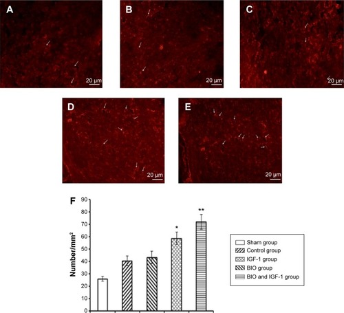 Figure 6 Immunostaining for the evaluation of angiogenesis.Notes: (A–D) CD31 immunostaining of the tissue sections from the MI among the (A) sham group, (B) control group, (C) IGF-1 release group, (D) BIO release group, and (E) BIO and IGF-1 co-delivery group. (F) Statistical analysis of the CD31-positive blood vessels (n=6). *P≤0.05 versus the control group; **P<0.01 versus the control group. The arrows point to the endothelial cells.Abbreviations: BIO, 6-bromoindirubin-3-oxime; IGF-1, insulin-like growth factor 1; MI, myocardial infarction.