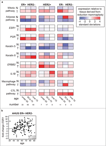 Figure 2. Expression of key genes and pathways in adjacent normal and tumor samples. (a) Relative expression of individual genes and pathways compared with 43 disease-free mammaplastic reduction tissue samples, grouped by age and hormone receptor status. Values were standardized by subtracting the corresponding median value for in mammaplastic reduction samples and dividing by the standard deviation across groups. Darker blue indicates lower expression than the median expression of all mammaplastic reduction, darker red indicates higher expression. (b) scatter plot of the fold-change in ESR1 expression plotted against patient age in ER-positive HER2-negative AHUS patients with a linear regression line fitted, showing a significant direct correlation.