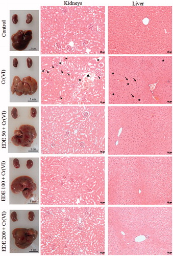 Figure 11. Histopathological analysis of mice liver and kidneys. The mice were pretreated with EDE for 10 days and exposed to a sublethal dose of Cr(VI) on the 11th day. On the 12th day, the animals were euthanized and liver and kidneys were collected for morphological analysis. Kidneys: destruction of the proximal tubules (asterisks), haemorrhagic areas (arrows) and loss of normal structure (head arrow). Liver: haemorrhagic foci (arrows) and necrotic areas (asterisks). Haematoxylin and eosin (H&E), 400×.