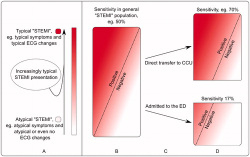 Figure 3. Schematic explanation of how sensitivity of STEMI criteria is affected in different populations.Although sensitivity and specificity are not related to the prevalence of disease (as opposed to PPV and NPV), they can still be affected by a difference in attributes of the patients.A. The entire population of patients with acute coronary occlusion is heterogeneous and patients may present with either typical ECG changes and typical symptoms on one end of the spectrum, or with atypical symptoms and atypical ECG changes on the other. In this illustration, patients with typical presentation are represented by an intense red color and patients with atypical presentation represented by pink/white colors.B: The rectangle represents all patients with acute coronary occlusion – here referred to as the general “STEMI” population. STEMI criteria have been assigned a hypothetical sensitivity, 50%, for the detection of acute coronary occlusion. Patients to the left of the dashed line meet STEMI criteria (positive), while patients to the right of the dashed line do not (negative).C: Patients with typical symptoms and/or typical ECG changes (more red) are more likely to be directed to the coronary care unit (CCU) than those with atypical presentation (pink/white), who instead are more likely to present at the emergency department (ED).D: Since atypical ECG changes are more common among those patients who present at the ED, STEMI criteria will not detect as many patients with acute coronary occlusion as in the population in B, i.e. sensitivity decreases.