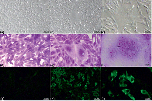 Figure 2. Biological properties in Vero cell cultures of prototype strain aMPV/A/chicken/Mx/Jal/2008. 2a: Mock-infected cells observed by phase contrast microscopy. 2b: Cultures infected with aMPV at 96 h post infection. 2c: Syncytia observed in cultures infected with aMPV at 96 h post infection. 2d: Mock-infected cells stained with crystal violet. 2e: Observation of large syncytia in cultures infected with aMPV at 96 h. 2f: Syncytia in cultures infected with aMPV at 96 h. 2g: Immunofluorescence of mock-infected cultures. 2h: Intracytoplasmic granular fluorescent staining in cultures infected with aMPV at 48 h post infection. 2i: Intracytoplasmic granular fluorescent staining in cultures infected with aMPV at 48 h post infection.