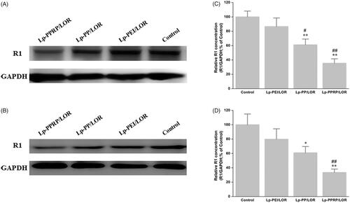 Figure 6. Down regulation of R1 protein expression in HeLa cells and A549 cells treated with Lp-PEI/LOR, Lp-PP/LOR, and Lp-PPRP/LOR. (A, C) HeLa cells. (B, D) A549 cells. *p < .05 vs. Lp-PEI/LOR, **p < .01 vs. Lp-PEI/LOR, #p < .05 vs. Lp-PP/LOR, and ##p < .01 vs. Lp-PP/LOR.