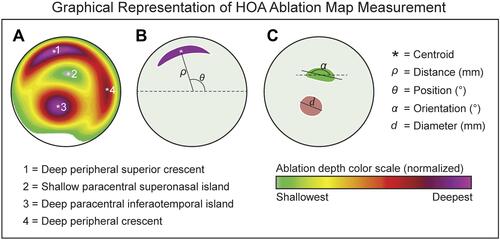 Figure 1 (A) Contoura HOA ablation map in a representative keratoconus eye. (B) Graphical representation of the distance from center and position features of an ablation island. The distance from center (ρ) is defined as the radius (in mm) between the origin of the HOA ablation map (X = 0 and Y = 0 coordinates) and the centroid of any ablation island. The centroid denoted by the white asterisk (*) is calculated as the arithmetic mean of the X and Y coordinates of all pixels forming the ablation island (in this example, all purple pixels). The orientation (θ) of the ablation island is defined as the angle (between 0 to 360º) formed between the centroid of the ablation island and the abscissa (dotted line). (C) Graphical representation of the orientation and diameter features of an ablation island. The orientation (α) of an ablation island is defined as the angle (reported between 0 to 180º) formed between the longest diagonal of the ablation island (termed major axis in geometry) and the dotted horizontal line passing by the centroid of the ablation island. The diameter of an ablation island was defined as the length of the major axis (d). In addition to the above-defined parameters, we calculated the area (mm2) and sphericity of each ablation island. The area was calculated by multiplying the number of pixels by the area of one pixel. The sphericity of an ablation island was defined as 4π times area divided by the square of the perimeter. Sphericity is equal to 1.0 for a perfect circle and it is smaller than 1.0 for an ellipse or a crescent shape.