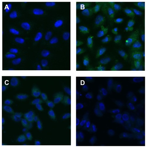 Figure 5 Laser scanning confocal microscope images (630×) showing fluorescent changes in osteopontin on African green monkey kidney epithelial cells after the adhesion of calcium oxalate dihydrate with the epithelial cells in the control group at (A) 0 hours, (B) 6 hours, (C) 12 hours, and (D) 24 hours. Note: The nucleus is blue, and the expressed osteopontin is green.