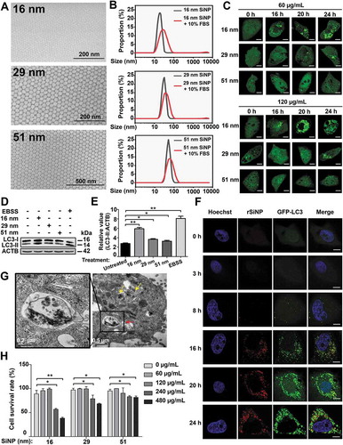 Figure 1. The effect of SiNPs with different sizes and doses on the induction of autophagy activation. (A) The morphology of 16-nm, 29-nm, or 51-nm SiNPs was observed using SEM. (B) The stability of synthesized SiNPs in near-physiological environment. (C) GFP-LC3 NRK cells were treated with 3 different sizes of SiNPs for 0, 16, 20, and 24 h and observed under the confocal microscopy. Scale bar: 5 μm. (D) NRK cells were incubated with the 3 sizes of SiNPs for 24 h or EBSS for 3 h, and (E) the protein levels of LC3-II were analyzed by immunoblotting. The relative expression of LC3-II was evaluated by the ratio of LC3-II:ACTB. (F) GFP-LC3 NRK cells were incubated with 16-nm rSiNPs at 60 μg/mL for 0, 3, 8, 16, 20, and 24 h, stained by Hoechst 33342 and imaged by laser scanning confocal microscopy. The rSiNP (red), GFP-LC3 (green), and Hoechst 33342 staining of the nuclei (blue) were shown. Scale bar: 5 μm. (G) TEM images of NRK cells treated with 16-nm SiNPs at 60 μg/ml for 24 h. Red arrow, double-membrane autophagosome; Yellow arrow, single-membrane autolysosome. (H) NRK cells were treated with the 3 sizes of SiNPs for 24 h with a final concentration of 0, 60, 120, 240 or 480 μg/mL, and the cell viability was measured by CCK-8 assay. * p < 0.05; ** p < 0.01