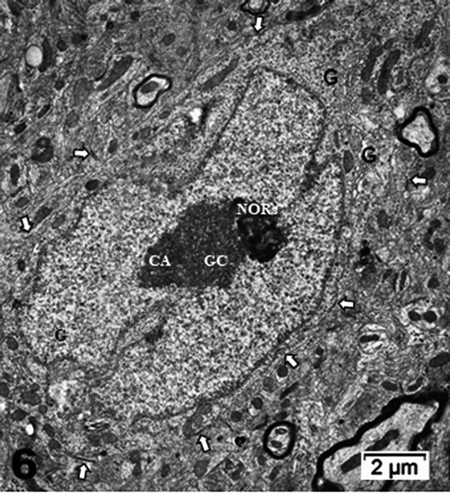 Figure 6. Neuron cell body of NN murine latero-ventral thalamic region. (a): Euchromatic nucleus with deeply indented envelope reaching, in its central zone, the large nucleolus and its 3 main aligned components indicating high transcription activities: CA: chromatin associated, GC: granular center (ribonucleoprotein components); CA+GC both forming nucleolar organizer centers or NORs; DF: dense fibrillar and FF: fine fibrillar region. G: Golgi apparatus; axo-somatic synapses are marked by small white arrows. Compare this micrograph with that of Figure 11a