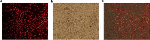 Figure 1. Fluorescent siRNA under the fluorescence microscope after 48 h transfection (×100). a: Fluorescence detection; b: Transmittance tests; c: Composite image.