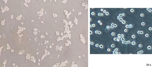 Figure 1 Observation of colon cancer stem cell growth under an inverted microscope (20×).