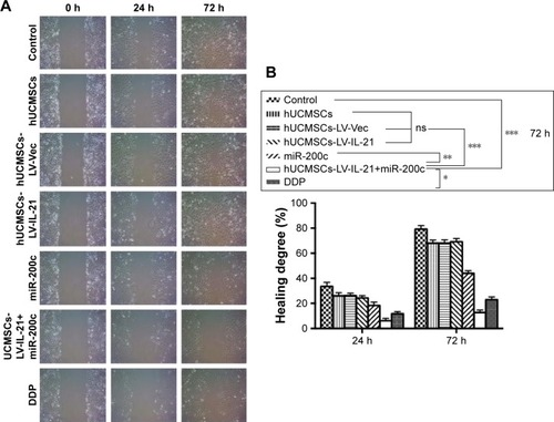 Figure 1 Analysis of the migration ability of SKOV3 cells treated with the different agents. (A) The migration ability of cells treated with the different agents detected by the wound healing assay. (B) The difference of cell healing degree percentage was statistically analyzed on 0 h, 24 h, and 72 h, respectively. *p < 0.05; **p < 0.01; ***p < 0.005.