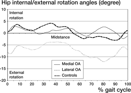 Figure 11. Mean value of hip or relative femoral internal/ external rotation angles related to a standardized gait cycle in women with medial or lateral OA and in the controls. See also legend to Figure 1.