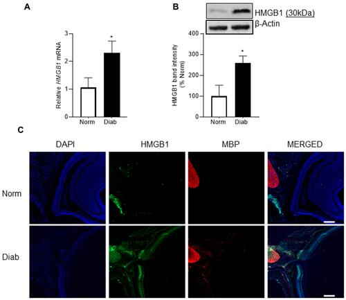 Figure 1 Effect of diabetes on HMGB1 expression in the optic nerve. HMGB1 expression was analyzed by quantifying (A) gene transcript by qRT-PCR using 18s as a housekeeping gene and (B) protein expression by Western blotting using β-actin as the loading protein. (C) Representative image of the co-localization of HMGB1 and MBP in optic nerve cryosections using DyLight-488 (green) and Texas Red (red) conjugated secondary antibodies. The sections were imaged at 5x objective, and the scale bar represents 200 μm. Each measurement was made in duplicate in 6 to 7 mice/group, and the histograms represent values mean ± SD. Norm, normal; Diab, diabetic mice; *P < 0.05 versus normal.