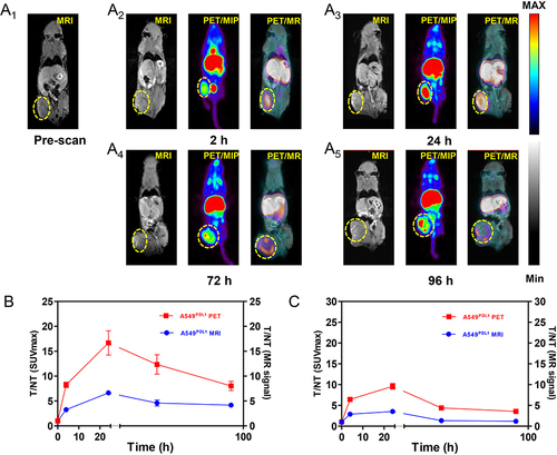 Figure 4 (A1–A5) T1-weighted MR axial images and PET/MR imaging of A549PDL1 model before and after injection of (89Zr, Mn)-WPMNs (tumor site enveloped by a yellow dotted line). (B) The distribution of PET/MRI assessed by the tumor vs muscle ratios of SUVmax and MR signal changed at non-block group as determined using the ROI, expressed as the mean ± SD. (C) The distribution of PET/MRI assessed by the tumor vs muscle ratios of SUVmax and MR signal changed at blocking group as determined using the ROI, expressed as the mean ± SD.