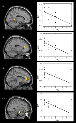 Figure 1.  Brain regions where the number of SLEs was associated with decreased GMV at follow-up relative to baseline. Images are from sagittal MRI scans; regions showing decreased volume are in yellow. These regions included (a) the parahippocampal gyrus (Z score: 3.54); (b) the left anterior cingulate (Z score: 3.40); (c) the right anterior cingulate (Z score: 3.22); and (d) the right hippocampus (Z score: 3.19). GMV was measured in terms of mm3 of gray matter per voxel from MRI scans. For illustrative purpose, statistical threshold for the figure was set to p < 0.01 (uncorrected).