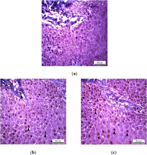 Figure 4. Immunohistochemical analysis of 8-OHdG expression as a DNA oxidation biomarker in rats with experimental oral mucositis investigating the therapeutic effect of EA. (a) In the control group where experimental oral mucositis was induced, 8-OHdG expression was not observed in the epithelial layer and lamina propria. Control Group, oral mucosa, Rat, IHC, Scale bar = 50 µm. (b) 8-OHdG expression (marked by arrowheads) in the nuclei of epithelial cells and inflammatory cells in the lamina propria of rats in Group I, where experimental oral mucositis was induced after the first 5 days of EA administration. Group I, oral mucosa, Rat, IHC, Scale bar = 50 µm. (c) 8-OHdG expression (marked by arrowheads) in the nuclei of epithelial cells of rats in Group II, who received EA for 5 days following the induction of experimental oral mucositis. Group II, oral mucosa, Rat, IHC, Scale bar = 50 µm.