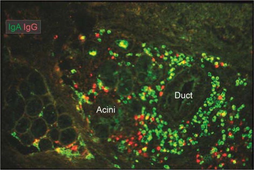 Fig. 7 Merge of paired immunofluorescence staining for IgA (green) and IgG (red) in section of saline-extracted and ethanol-fixed specimen (Citation16) of buccal minor salivary gland. Note that there is a relatively dense population of plasma cells compared with major salivary glands (cf. Fig. 5), and that IgG-producing cells are quite abundant at the periphery. Both ducts and serous parts of acini show faint selective staining for IgA, reflecting external transport (original magnification: ×80).