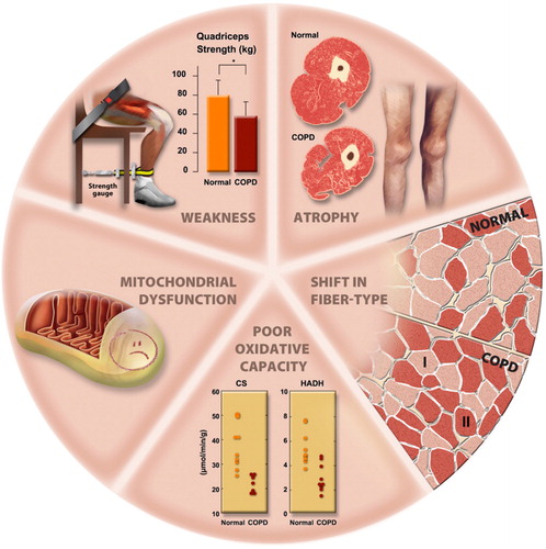 Figure 9 Morphological and structural alterations reported in limb muscles in patient with COPD. Reprinted with permission of the American Thoracic Society. Copyright © 2018 American Thoracic Society. Maltais et al. (Citation11).