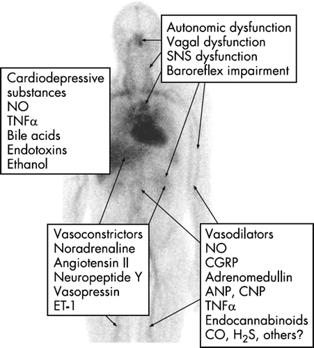 Figure 2.  Cardiovascular hyporeactivity in cirrhosis may originate in the central nervous system, the autonomic nervous system, from local mediators, or within the heart muscle cell. The balance between vasodilatators and vasocontrictors is different in different vascular beds. Abbreviations: CGRP: Calcitonin gene-related peptide; ANP: atrial natriuretic peptide; CNP: C-type natriuretic peptide, TNFα: tumor necrosis factor-alpha; ET: endothelin; SNS: systemic nervous system.