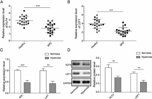Figure 1. The expression of KLF4/Klf4 and LEF1/Lef1 are diminished in Clinical BPD serum samples and hyperoxia-induced MLE-12 cells. A-B. The levels of KLF4 and LEF1 in serum samples from BPD patients (n = 20) and healthy volunteers (n = 20) were evaluated utilizing qRT-PCR, male: grey, female: black; C. Klf4 and Lef1 expression were measured by qRT-PCR; D. The levels of KLF4 and LEF1 in MLE-12 cells induced by hyperoxia were evaluated utilizing western blot. Data were displayed as mean ± SD (n = 3), and analyzed utilizing t test; **, p < 0.01; ***, p < 0.001.
