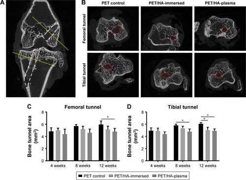 Figure 2 Micro-CT analysis of tibial and femoral bone tunnel size.Notes: (A) Coronary view of femoral and tibial bone tunnel after ACL reconstruction showing the plane selected for bone tunnel area analysis. (B) Transactional sections of femoral and tibial bone tunnels in the PET/HA-plasma group, PET/HA-immersed group, and PET control group. Average (C) femoral and (D) tibial bone tunnel area in the PET/HA-plasma group, PET/HA-immersed group, and PET control group at 4, 8, and 12 weeks postoperatively. *p<0.05.Abbreviations: micro-CT, micro-computed tomography; ACL, anterior cruciate ligament; PET, polyethylene terephthalate; HA, hydroxyapatite.