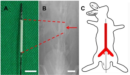 Figure 2 Stent and angiograms in rabbit descending aorta. (A) Photograph of vildagliptin-eluting stent. The nanofibrous tube was made on a bare-metal stent. (Scale bar: 5 mm) (B) Angiograms of rabbit vasculature in area of stent implantation (red arrow head) (scale bar: 10 mm) following injection of contrast dye from femoral artery (red asterisk). (C) Locations of rabbit vasculature.