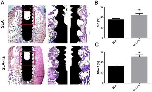 Figure 8 Ta-modification-enhanced bone osseointegration at 4 weeks. (A) After implantation for 4 weeks, the undecalcified sections were stained with van Gieson’s. The BIC (B) and BDWT (C) of the bone adjacent to the implant surface in ROI. The area of interest (ROI, the red rectangle area of A) was for the analysis of BIC and BDWT. *P<0.5, significantly different from the control SLA group.