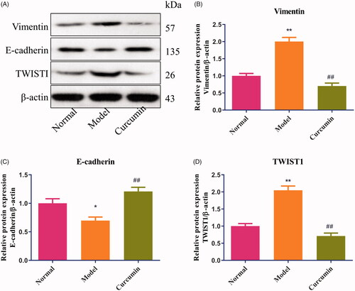 Figure 2. Effect of curcumin on E-cadherin, vimentin and TWIST1 proteins in renal tissues of DN-induced rats. (A) The levels of E-cadherin, vimentin and TWIST1 proteins from renal tissues were detected by Western blot and normalized to β-actin and then (B–D) relative band intensities were used in order to quantify E-cadherin, vimentin and TWIST1 protein. *p < 0.05, **p < 0.01 vs. the normal group, ##p < 0.01 vs. the model group.