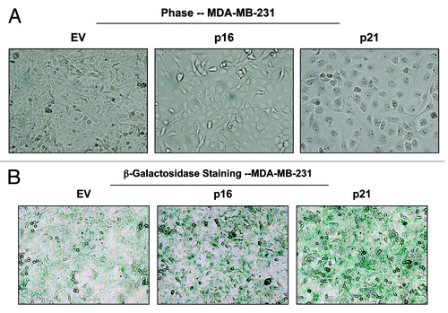 Figure 14. MDA-MB-231 breast cancer cell lines, which overexpress p16(INK4A) and p21(WAF1/CIP1), show signs of senescence. (A) Cell hypertrophy. MDA-MB-231 cells, which overexpress p16(INK4A) and p21(WAF1/CIP1), morphologically appear flatter or hypertrophic. Representative phase images are shown. (B) Beta-galactosidase. MDA-MB-231 cells, which overexpress p16(INK4A) and p21(WAF1/CIP1), also appear to have increased β-galactosidase activity.