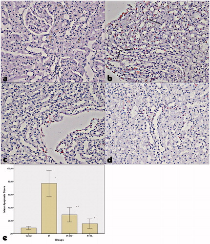 Figure 3. Examination of tunel + cells in kidney tissues in the experimental groups. The positive TUNEL reaction is visible as a dark brown apoptosis in control rats. (a) control group, (b) ischemia-reperfusion group, (c) captopril + ischemia-reperfusion group, (d) telmisartan + ischemia-reperfusion group. Significant positive cell count was identified in IR injury comparing to control. TUNEL + cell count was increased in IR group comparing to control group. TUNEL + cell count was significantly lower in IR + CAP and IR + TEL groups comparing to IR group. p shows the differences between all groups (one-way ANOVA test). *<.001, compared to the control group; α<.001, compared to the IR group (post hoc Tukey’s test).