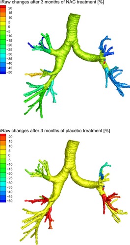 Figure 2 Changes in iRaw after 3 months of treatment with NAC (top) and placebo (bottom) in iRaw responders.Abbreviations: NAC, N-acetylcysteine; iRaw, image-based resistance.