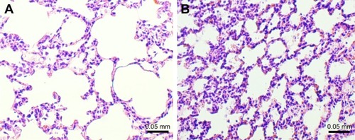 Figure 3 Microscopic examination of lung tissue in guinea pigs exposed to smoke (study group) and air (control group).