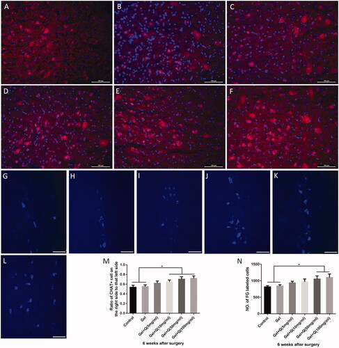 Figure 6. Survival rates and cell numbers of anterior horn motoneurons in the injured side of the spinal cord 6 weeks after surgery in the control group, blank hydrogel group, 5 mg/mL quercetin-loaded hydrogel group, 10 mg/mL quercetin-loaded hydrogel group, 50 mg/mL quercetin-loaded hydrogel group, and 100 mg/mL quercetin-loaded hydrogel group. (A–F) ChAT (+) neuron staining (red) and nuclear DAPI staining (blue) of the C6 spinal cord anterior horn in the injured side (scale bar = 100 μm); (G–L). The fluorescence side of the C5–C8 spinal anterior horn of the injured side was reversed (n = 3, scale bar = 100 μm); (M) The ratio of C6 spinal anterior horn to contralateral spinal anterior horn motor neurons in the injured side in the 6 groups (n = 3, *p < .05); (N) Number of fluorescent gold reverse neurons in the C5–C8 spinal cord in the injured side in the 6 groups (n = 3, *p < .05).