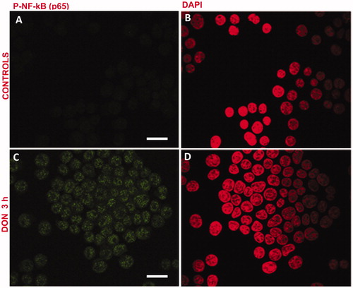 Figure 4. DON activates NF-κB (p65) in Jurkat cells. Cells were treated with 0.5 μM DON for 3 h. (A, B) untreated; (C, D) treated. (A, C) NF-κB (p65) staining; (B, D) DNA staining with DAPI. Scale bar: 23 μm.